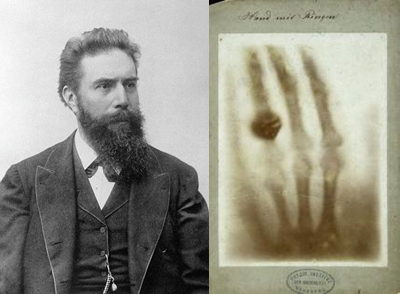 Fig. 1 - Wilhelm Conrad Rontgen (1845-1923) e, a destra, la prima radiografia del mondo: la mano di sua moglie con un vistoso anello al dito. Questa radiografia e' stata ottenuta nel Novembre 1895, pochi giorni dopo la scoperta dei raggi X.